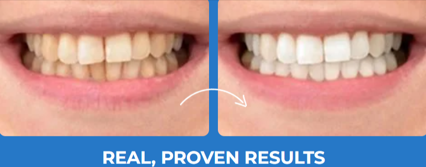 Gleam Mint Teeth Whitening Powder Benefits