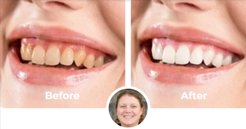 Gleam Mint Teeth Whitening Powder Customer Reviews