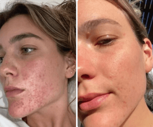 ParaMD Parasite Cleanse Australia customer 1