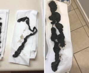 ParaMD Parasite Cleanse Australia customer 2